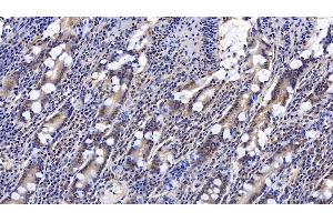 Detection of CNX in Human Small intestine Tissue using Monoclonal Antibody to Calnexin (CNX)