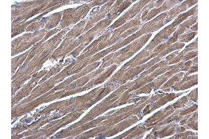 IHC-P Image RRAS antibody [N1C3] detects RRAS protein at cytoplasm on mouse heart by immunohistochemical analysis.