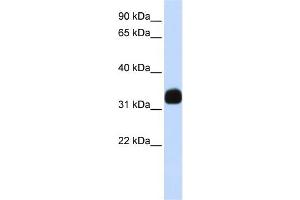 WB Suggested Anti-MED27 Antibody Titration: 0.