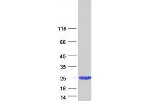 Validation with Western Blot