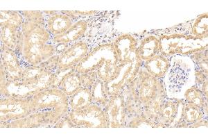 Detection of IL9 in Human Kidney Tissue using Polyclonal Antibody to Interleukin 9 (IL9) (IL-9 anticorps  (AA 19-144))