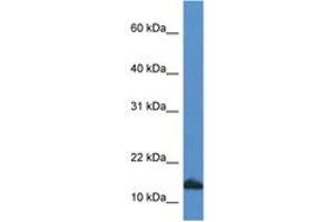 Image no. 1 for anti-Cytidine Deaminase (CDA) (C-Term) antibody (ABIN6746945) (CDA anticorps  (C-Term))