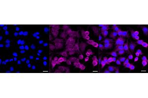 Immunocytochemical staining of HeLa cells with GNE antibody (ABIN7798730), 1:1,000). (Recombinant GNE anticorps)