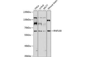 Western blot analysis of extracts of various cell lines, using RNF168 antibody (ABIN1682548, ABIN3017831, ABIN3017832 and ABIN6220281) at 1:1000 dilution. (RNF168 anticorps  (AA 300-571))