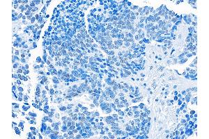 Immunohistochemistry (IHC) image for anti-Bromodomain Containing 3 (BRD3) (AA 676-726) antibody (ABIN7455203) (Recombinant BRD3 anticorps  (AA 676-726))