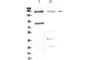 Western blot analysis of Niemann Pick C1 using anti-Niemann Pick C1 antibody . (NPC1 anticorps  (AA 1022-1278))