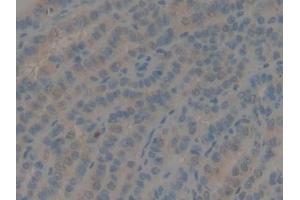 Detection of GDF10 in Human Thyroid Tissue using Polyclonal Antibody to Growth Differentiation Factor 10 (GDF10) (GDF10 anticorps  (AA 337-477))