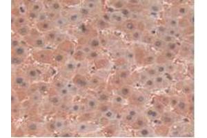 IHC-P analysis of Human Liver Tissue, with DAB staining. (CLIC1 anticorps  (AA 79-241))