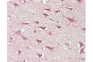 Anti-SLCO6A1 / OATP-I antibody IHC staining of human brain, cortex.