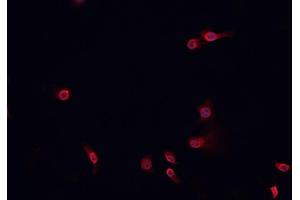 ABIN6268843 staining HeLa cells by IF/ICC. (NOTCH2 anticorps)