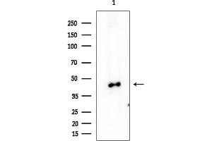 anti-Suppression of Tumorigenicity 13 (ST13) antibody
