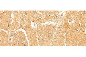 Immunohistochemistry of paraffin-embedded Human brain tissue using PPP1R1A Polyclonal Antibody at dilution of 1:50(x200) (PPP1R1A anticorps)