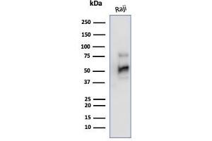 Western Blot Analysis of Raji cell lysate using CD79a Mouse Monoclonal Antibody (JCB117). (CD79a anticorps  (AA 202-216))