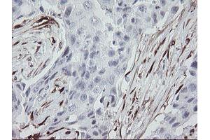 Image no. 6 for anti-Coagulation Factor XIII, A1 Polypeptide (F13A1) antibody (ABIN1498150)