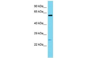 Western Blotting (WB) image for anti-Sperm Associated Antigen 7 (SPAG7) (N-Term) antibody (ABIN2790586) (SPAG7 anticorps  (N-Term))