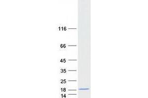 Validation with Western Blot