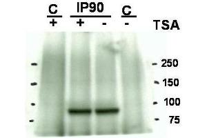 Western blot using  Affinity Purified anti-Hsp90 acetyl K294 antibody shows detection of a band at ~90 kDa corresponding to Hsp90 in an SkBr3 cell lysate (arrowhead) after treatment with Trichostatin A (an HDAC inhibitor). (HSP90 anticorps  (Lys294))