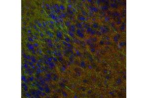 Indirect immunostaining of PFA fixed mouse brain section with anti-synaptogyrin 1 (dilution 1 : 500; red) and mouse anti-MAP 2 (cat.