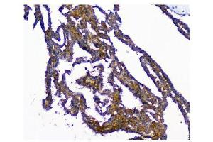 IHC analysis of NMI using anti-NMI antibody (ABIN3043451). (NMI anticorps  (AA 2-307))