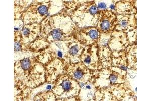 Immunohistochemistry (IHC) image for anti-V-Akt Murine Thymoma Viral Oncogene Homolog 1 (AKT1) (N-Term) antibody (ABIN1031225) (AKT1 anticorps  (N-Term))