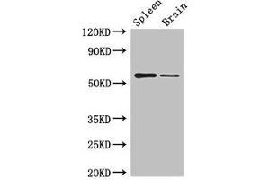 Western Blot Positive WB detected in: Mouse spleen tissue, Mouse brain tissue All lanes: D2HGDH antibody at 3 μg/mL Secondary Goat polyclonal to rabbit IgG at 1/50000 dilution Predicted band size: 57, 33, 35 kDa Observed band size: 57 kDa (D2HGDH anticorps  (AA 14-521))