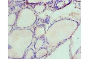Immunohistochemistry of paraffin-embedded human thyroid tissue using ABIN7155960 at dilution of 1:100