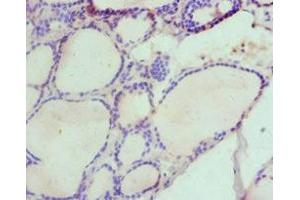 Immunohistochemistry of paraffin-embedded human thyroid tissue using ABIN7155960 at dilution of 1:100 (HAS3 anticorps  (AA 339-553))