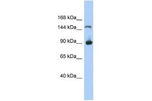 WB Suggested Anti-MGC50722 Antibody Titration: 0. (MGC50722 anticorps  (N-Term))