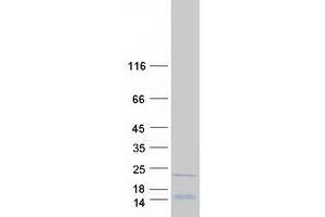 Validation with Western Blot