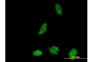 Immunofluorescence of purified MaxPab antibody to ICT1 on HeLa cell. (ICT1 anticorps  (AA 1-206))