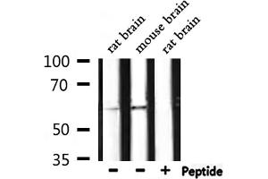 Western blot analysis of extracts from rat brain, mouse brain, using Phospho-HDAC3 (Ser424) Antibody.