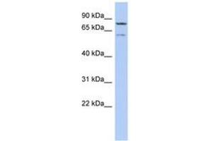 Image no. 1 for anti-Oxidative Stress Induced Growth Inhibitor 1 (OSGIN1) (AA 143-192) antibody (ABIN6743900) (OSGIN1 anticorps  (AA 143-192))