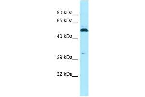 WB Suggested Anti-SPAM1 Antibody Titration: 1. (SPAM1 anticorps  (C-Term))