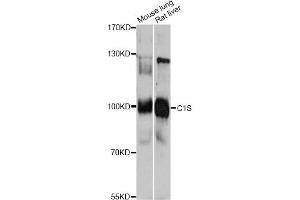 Western blot analysis of extracts of various cell lines, using C1S antibody. (C1S anticorps)