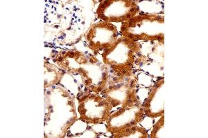 Immunohistochemical analysis of paraffin-embedded R.