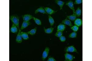 IF analysis of GLB1/Beta-galactosidase using anti-GLB1/Beta-galactosidase antibody (ABIN7601806). (GLB1 anticorps  (AA 46-655))