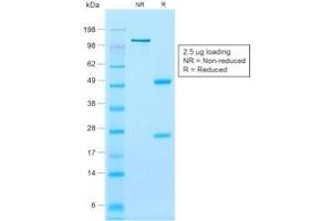 SDS-PAGE Analysis Purified Calponin-1 Recombinant Mouse Monoclonal Antibody (rCNN1/832).