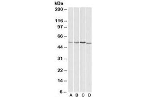 Western blot testing of HepG2 [A], Jurkat [B], mouse brain [C] and rat brain [D] lysates with AKT3 antibody at 1ug/ml. (AKT3 anticorps)