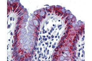 Immunohistochemistry (IHC) image for anti-Anterior Gradient Homolog 2 (Xenopus Laevis) (AGR2) (Middle Region) antibody (ABIN2775338)