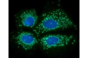 ICC/IF analysis of PDKZ1 in Hep3B cells line, stained with DAPI (Blue) for nucleus staining and monoclonal anti-human PDKZ1 antibody (1:100) with goat anti-mouse IgG-Alexa fluor 488 conjugate (Green). (PDZK1 anticorps)
