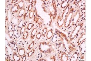 Formalin-fixed and paraffin embedded human kidney labeled with Anti-MELK/HPK38 Polyclonal Antibody, Unconjugated  at 1:200 followed by conjugation to the secondary antibody and DAB staining. (MELK anticorps  (AA 101-250))