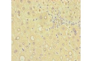 Immunohistochemistry of paraffin-embedded human liver tissue using ABIN7170745 at dilution of 1:100 (SAMD7 anticorps  (AA 1-300))