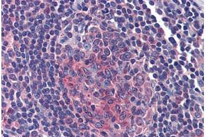 Human Tonsil: Formalin-Fixed, Paraffin-Embedded (FFPE)