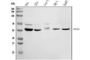 Western blot analysis of HEXA using anti-HEXA antibody (ABIN5518688).