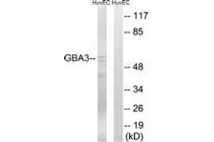 Western blot analysis of extracts from HuvEc cells, using GBA3 Antibody. (GBA3 anticorps  (AA 291-340))