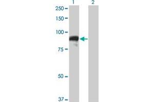 Western Blot analysis of TOP3B expression in transfected 293T cell line by TOP3B monoclonal antibody (M05), clone 4H7. (TOP3B anticorps  (AA 1-862))