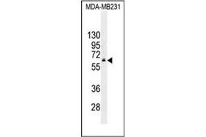 Western blot analysis of HNF1 beta / TCF2 Antibody (C-term) in MDA-MB231 cell line lysates (35ug/lane). (HNF1B anticorps  (C-Term))