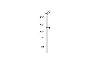 Western blot analysis of lysate from 293 cell line, using XIP1 Antibody (N-term) (ABIN6243937 and ABIN6577596).