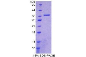 SDS-PAGE (SDS) image for ATP-Binding Cassette, Sub-Family A (ABC1), Member 1 (ABCA1) (AA 1385-1663) protein (His tag) (ABIN1878614)