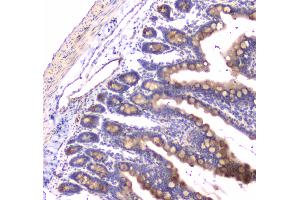 IHC analysis of RAB27A using anti-RAB27A antibody .